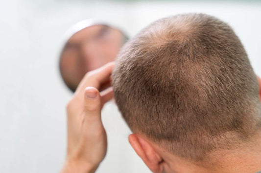 A man examining his thinning hair in the mirror, symbolizing stress-induced hair loss. stress hair recovery, male hair thinning solutions, biotin for hair regrowth, daily hair wellness, anti-stress scalp care