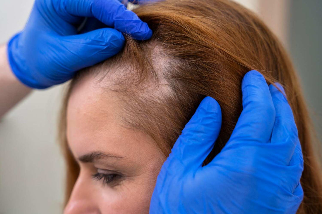 A clinician examining thinning hair at the scalp, highlighting alopecia means. genetic hair thinning, scalp inflammation control