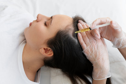 Close-up of a medical professional holding a syringe while preparing to administer an intralesional injection for hair loss treatment on a balding man.
