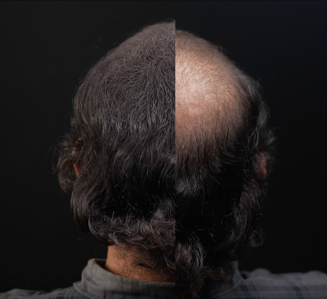 HairBOLD Hair Loss Concealer